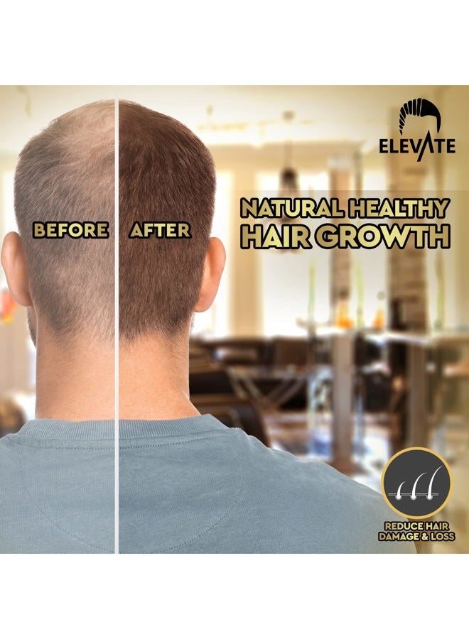ELEVATE Hair Growth Oil - Biotin Serum & Castor Oil Natural Vitamin Treatment for Stronger, Thicker, Longer Hair and Regrowth - Prevent Thinning and Loss for Men & Women, 1 Fl Oz - Image 4