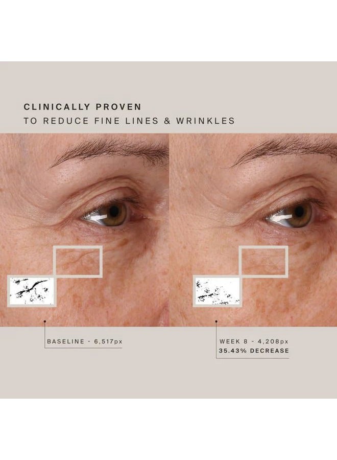 HIGHERDOSE Red Light Therapy Face Mask - Cordless At-Home LED Facial Light Therapy - Promotes Cellular Renewal, Healing, & Glowing Skin - LED Face Mask to Target Fine Lines, Wrinkles & Redness - Image 5