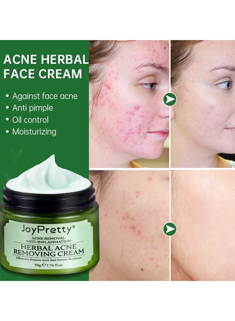 JoyPretty Acne Face Cream Herbal Pimple Scar Removal Shrink Pore Oil Control Moisturizing Facial Cream Acne Treatment Skin Care - Image 3