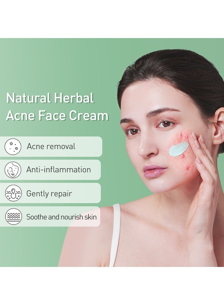 JoyPretty Acne Face Cream Herbal Pimple Scar Removal Shrink Pore Oil Control Moisturizing Facial Cream Acne Treatment Skin Care - Image 2