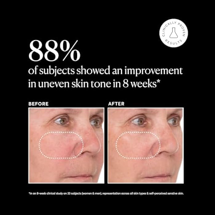 Naturium Vitamin C Super Serum Plus, Smoothing Face Care, plus Retinol, Hyaluronic Acid, Niacinamide & Salicylic Acid, 1 oz - Image 5