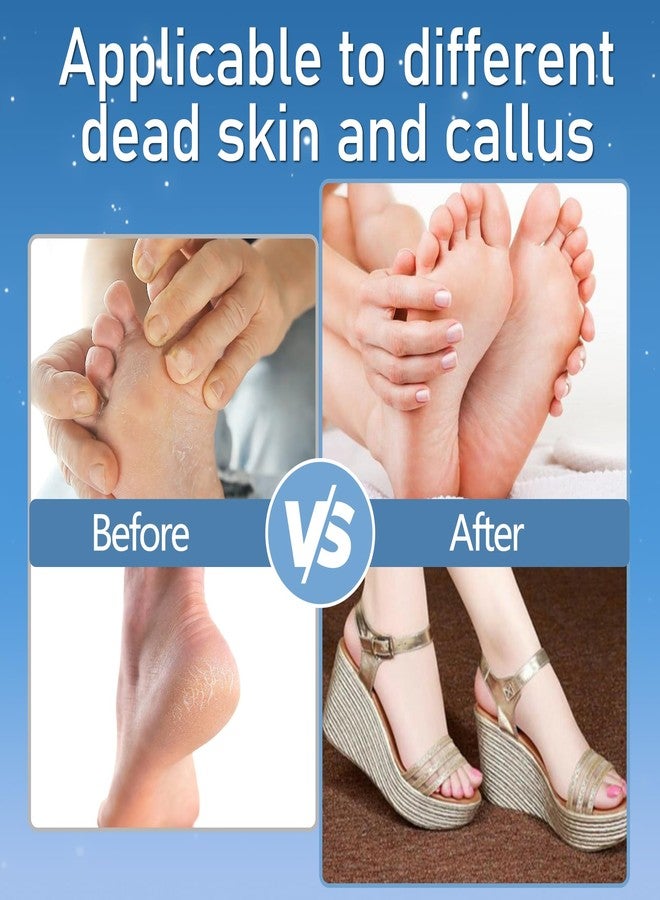 Jamestry Callus Remover for Feet, Electric Foot Callus Remover Waterproof with 3 Rollers 2 Speed Battery Display,17 in1 Rechargeable Foot File Pedicure Kits for Dead Hard Cracked Dry Skin - Image 4