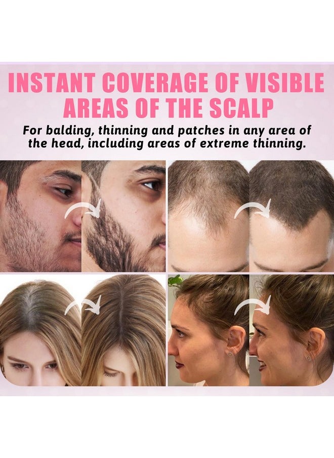 ZENTANMEI ZENTANMEI Root Touch Up Hairline Powder for Women & Men, Gray Hair Cover Up, Hairline Shadow Powder Sweatproof & Windproof, 0.14 oz Root Cover Up for Thinning Hair (Red Brown, 0.14)  - Image 3