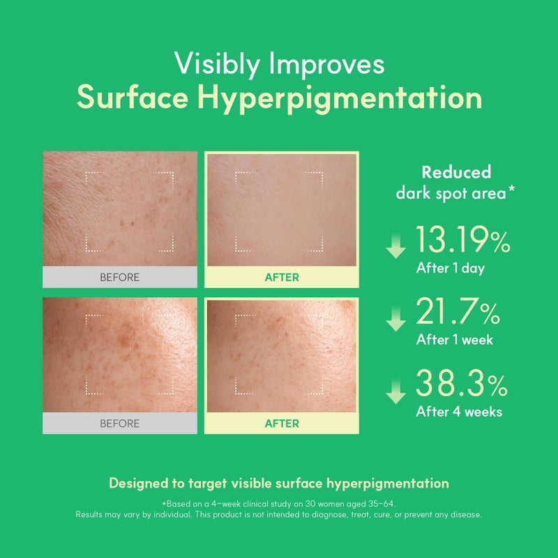 Easydew DW-EGF Melatoning Ampoule 3X - Hydrating Dark Spot Serum with Niacinamide & Glutathione for Uneven Skin - Fast Absorbing Day & Night Ampoule Korean Skin Care (Bottle 1.01 fl oz, EGF 3X) - Image 3