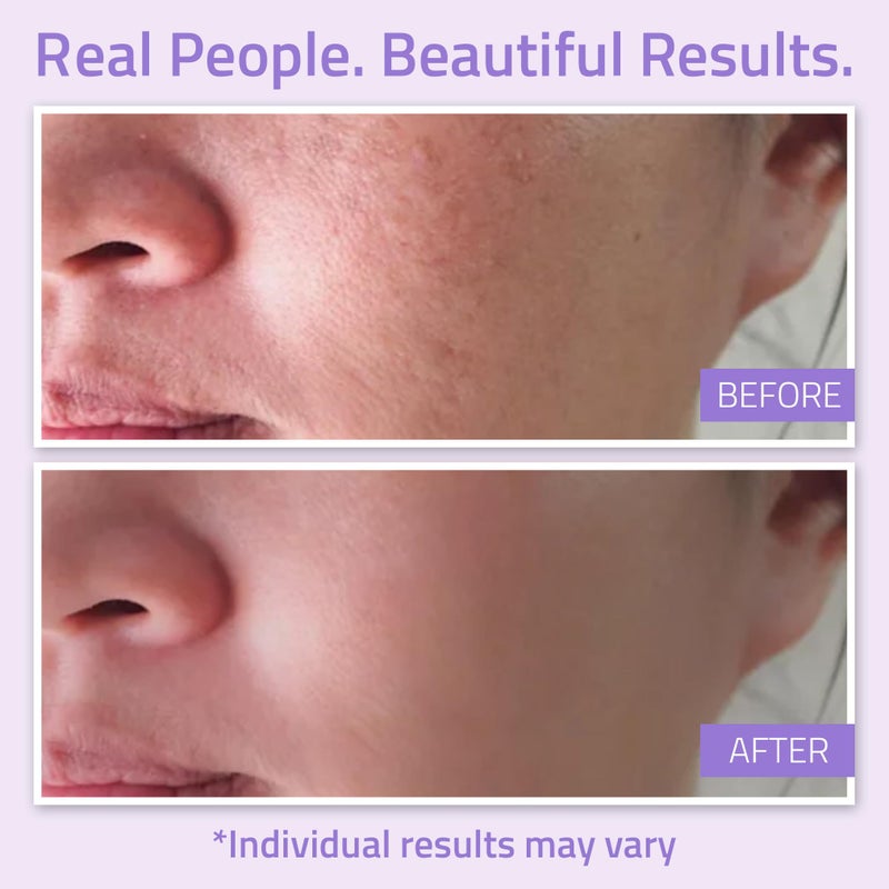 YEOUTH Hydrating Toner for Face Spray with Chamomile and Allantoin, Alcohol Free Facial Care, Refreshing Skin Care Face Toner for Women and Men 3.4 Oz - Image 4