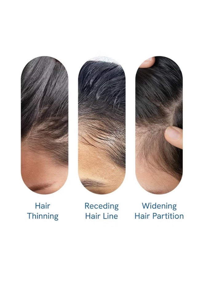 Be Bodywise 3% Redensyl & Rosemary Hair Growth Serum (Roll On) | Pack of 1 | 2% Anagain - Image 4