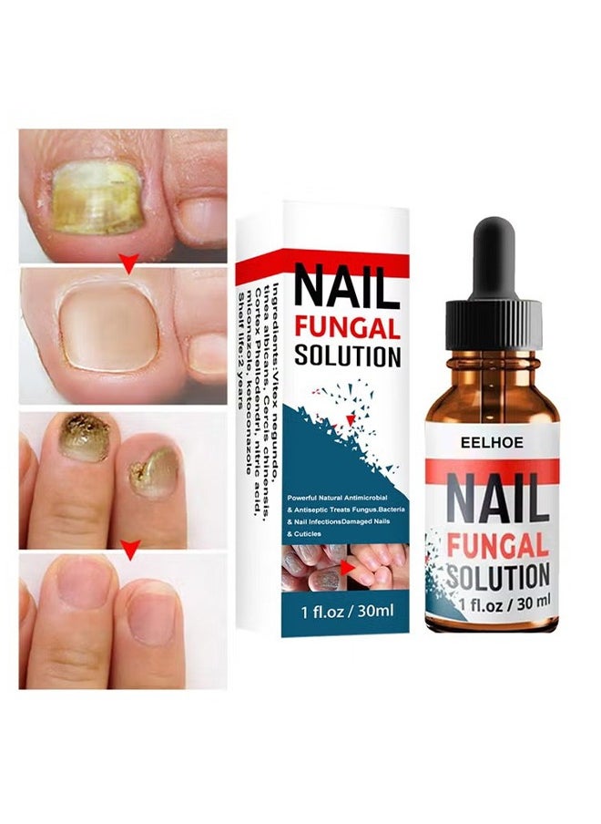 Nail Repair Solution Hand and Foot Nail Fungus Care Repairs Nail Fungus Fluid to Thicken Soft Nails Onychomycosis Care - pzsku/ZC7FAC5A2825BD8E4ACF1Z/45/_/1718848105/392cd7ca-a95c-4bc3-98a5-3849afcec915