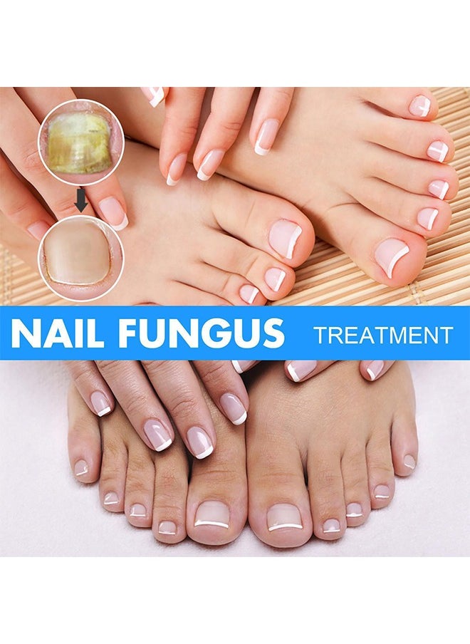 Nail Repair Solution Hand and Foot Nail Fungus Care Repairs Nail Fungus Fluid to Thicken Soft Nails Onychomycosis Care - pzsku/ZC7FAC5A2825BD8E4ACF1Z/45/_/1718848107/6851a399-5f3c-4c5c-a715-2d02e1d46103