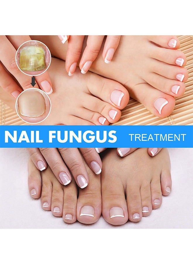 EELHOE Nail Repair Solution Hand and Foot Nail Fungus Care Repairs Nail Fungus Fluid to Thicken Soft Nails Onychomycosis Care - Image 4