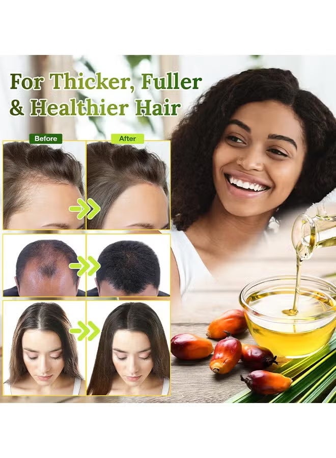 BabboSow Raw Batana Oil - 100% Natural And Organic Hair Growth Oil Solution For Men And Women, Raw, Unrefined, Enhances Thickness, Prevents Hair Loss - Image 4