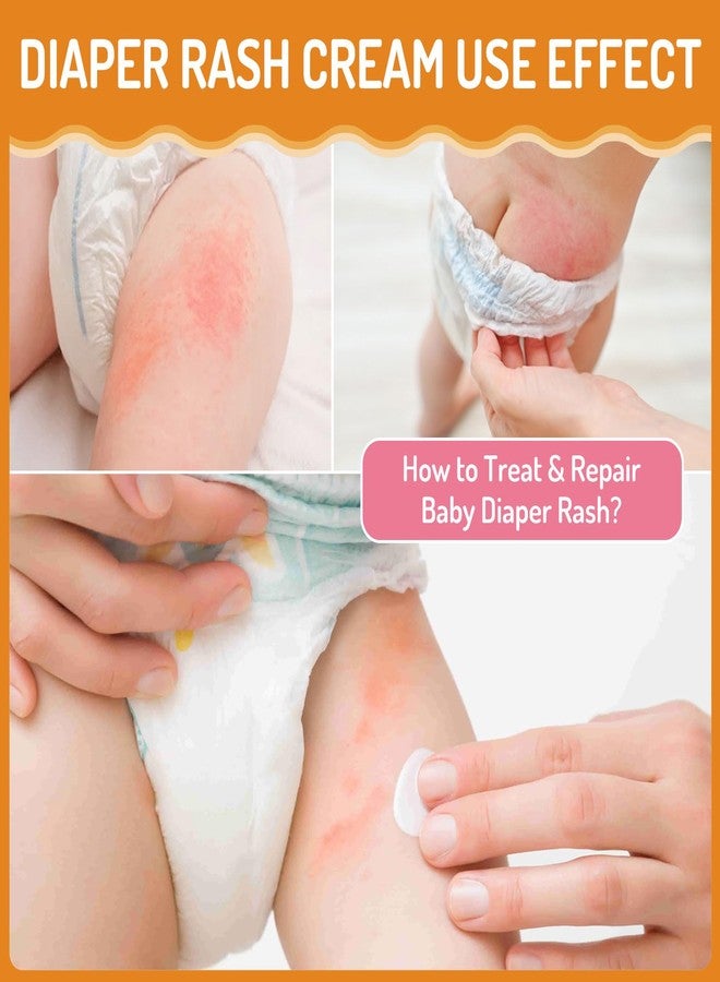 AOAO Baby Diaper Rash Cream, for Prevent, Soothe and Treat Breakouts Diaper Rash and Flare-Ups, Instant Soothing Baby Skin Discomfort, Fast Relief for Diaper Rash, Gentle Nappy Rash Ointment, 100ml/3.38oz - Image 5