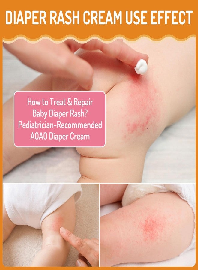 AOAO Baby Diaper Rash Cream, for Prevent, Soothe and Treat Breakouts Diaper Rash and Flare-Ups, Instant Soothing Baby Skin Discomfort, Fast Relief for Diaper Rash, Gentle Nappy Rash Ointment, 100ml/3.38oz - Image 4