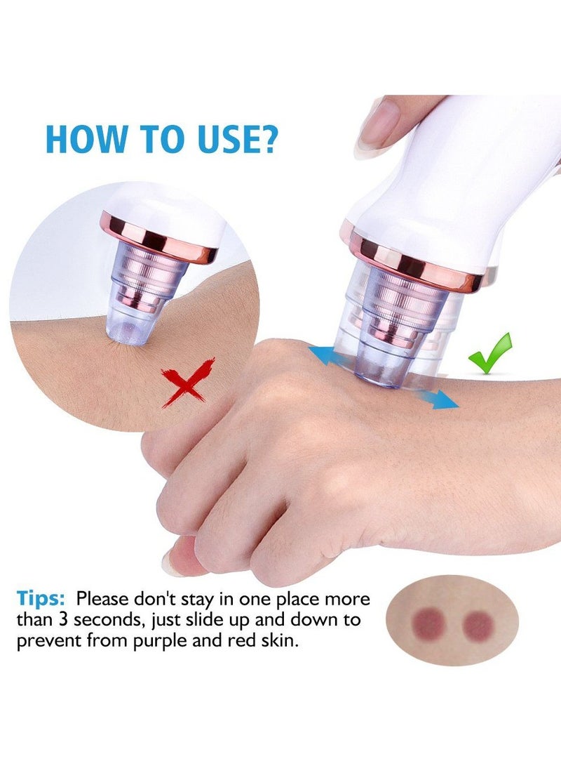 Facial Diamond Pore Vacuum – Rechargeable Blackhead & Acne Remover for All Skin Types - Image 5