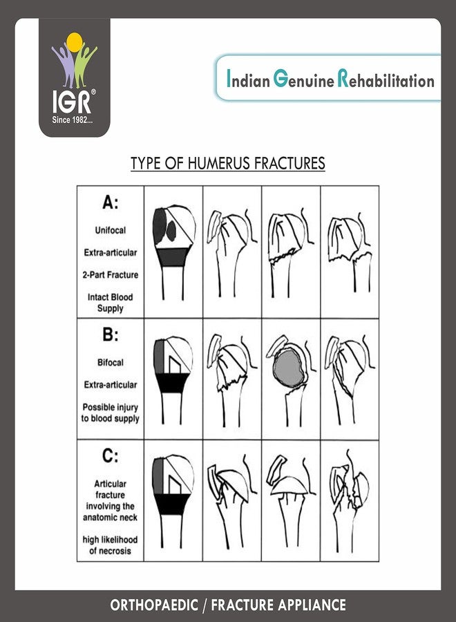 IGR دعامة عظم العضد IGR | جبيرة من الألياف البلاستيكية | محاذاة الكسور - منتصف عظم العضد | تثبيت عظم العضد المستقر | كسور فوق اللقمة المستقرة | كبير الحجم (85-120 كجم) - Image 4