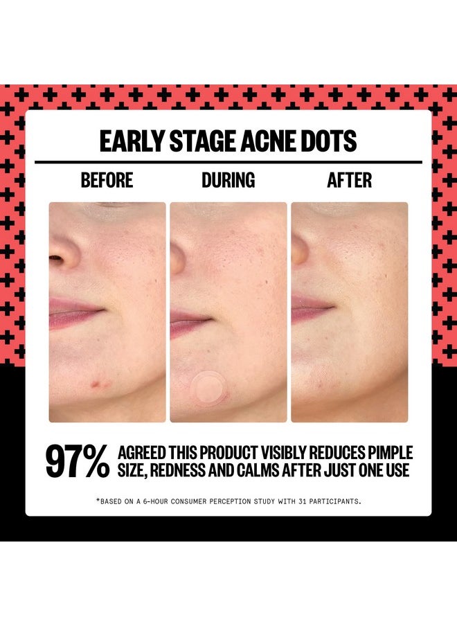 PEACE OUT - Early Stage Acne Dots Acnefighting Pimple Patches Salicylic Acid Unclogs Pores And Targets Acne Blemishes (8 Acne Dots) - Image 1