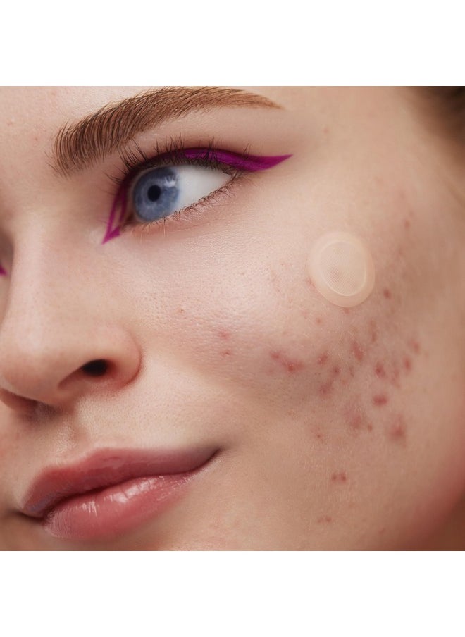 PEACE OUT - Early Stage Acne Dots Acnefighting Pimple Patches Salicylic Acid Unclogs Pores And Targets Acne Blemishes (8 Acne Dots) - Image 1