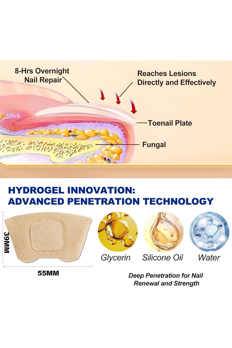 سيفودون علاج فطريات الأظافر القوة الإضافية - 32 قطعة فطريات الأظافر التصحيحات ، إصلاح الأظافر للأظافر المتضررة ، تجديد بين عشية وضحاها للرجال والنساء - Image 3
