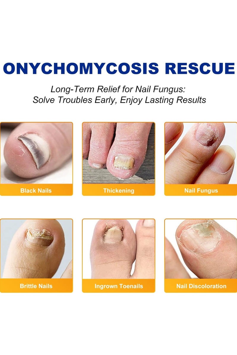 سيفودون علاج فطريات الأظافر القوة الإضافية - 32 قطعة فطريات الأظافر التصحيحات ، إصلاح الأظافر للأظافر المتضررة ، تجديد بين عشية وضحاها للرجال والنساء - Image 4
