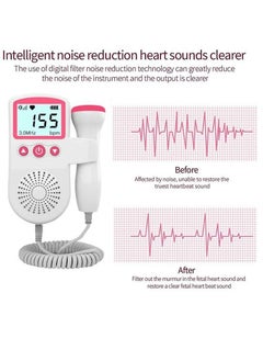 HAVEN Fetal Doppler,Portable Ultrasound Doppler Fetal Heart Rate Monitor with LCD Screen Prenatal Heartrate Monitor  - Image 5