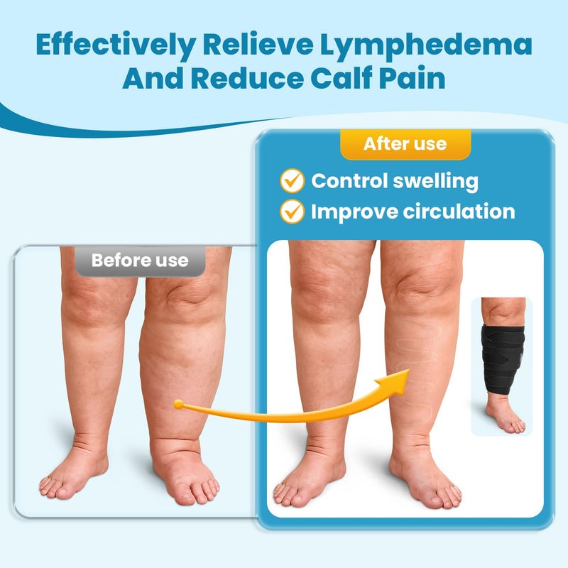 iDonuaÂ® Calf Lymphedema Compression Wrap Adjustable For Big Swollen Lower Leg - with 6 Cross Strapsâ€Œ (Tall-L) - Image 5