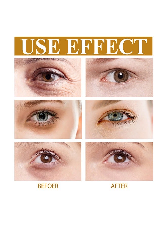 EELHOE Carnosine Eye Oil, Anti-Aging Serum For Dark Circles And Puffiness, Bags, Crows Feet, Wrinkles, With Hyaluronic Acid And Skin-Firming Peptides Eye Serum - Image 4