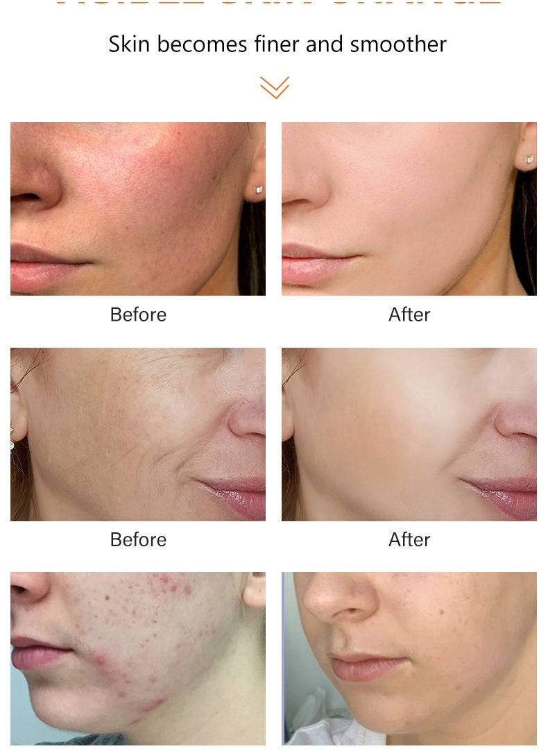 MOOYAM - Kojic Acid Face cream Anti Aging Wrinkle Acne Dark Spot Removing Whitening Face Cream 50g - Image 1