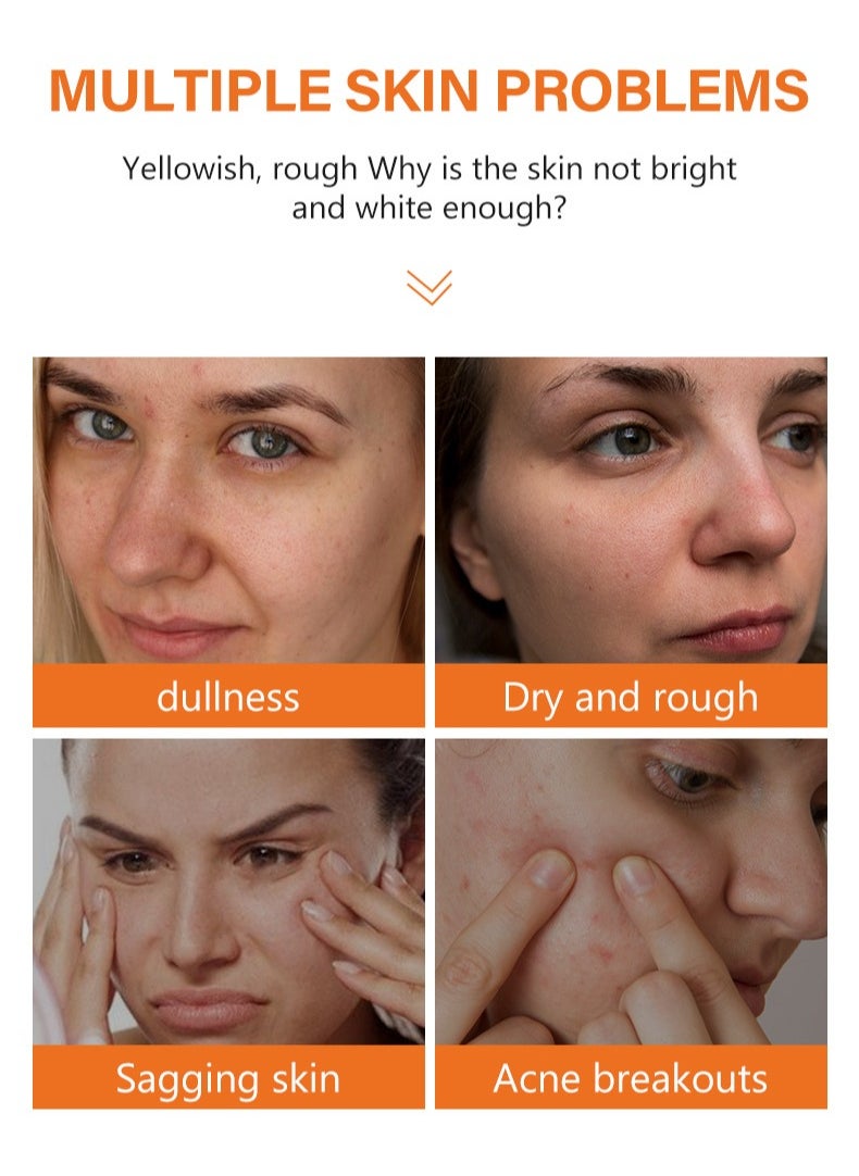 MOOYAM - Kojic Acid Face cream Anti Aging Wrinkle Acne Dark Spot Removing Whitening Face Cream 50g - Image 1
