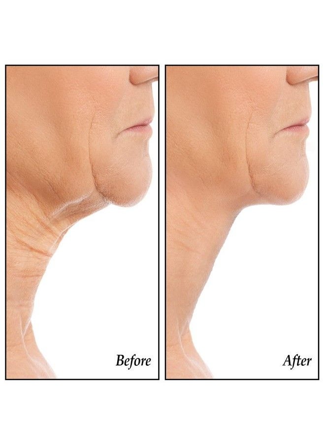 Collections Etc - Dermactints Crepe Be Gone Skin Firming Collagen Chin Mask .35 Ounce Packette - Image 1