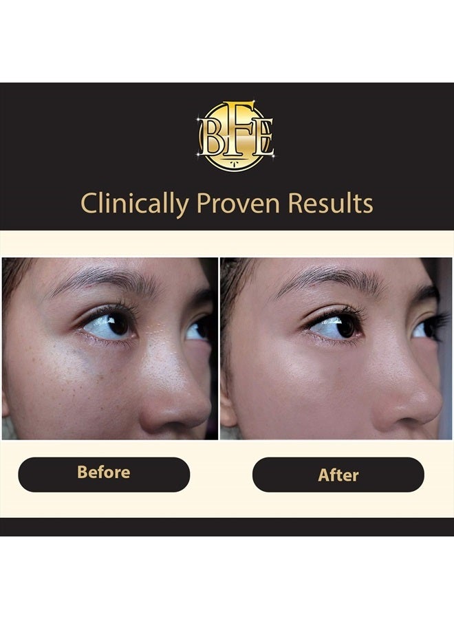 Beauty Facial Extreme سيروم تصحيح البقع الداكنة - يقلل بشكل ملحوظ من تغير لون البشرة المرتبط بالبقع الداكنة، بقع الشمس، بقع العمر، ندبات حب الشباب، البقع البنية، والنمش للرجال والنساء. - Image 2