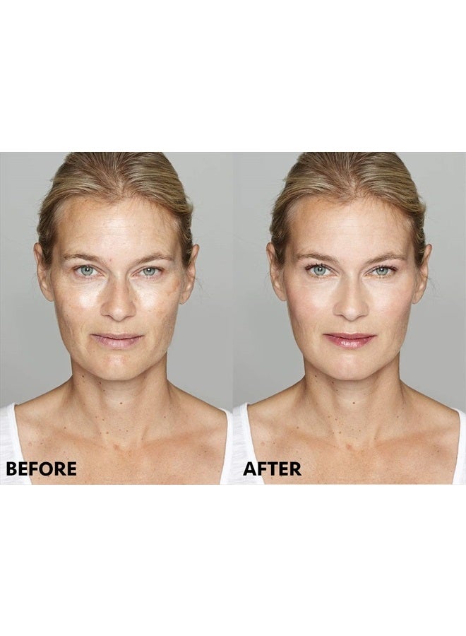 Beauty Facial Extreme سيروم تصحيح البقع الداكنة - يقلل بشكل ملحوظ من تغير لون البشرة المرتبط بالبقع الداكنة، بقع الشمس، بقع العمر، ندبات حب الشباب، البقع البنية، والنمش للرجال والنساء. - Image 4