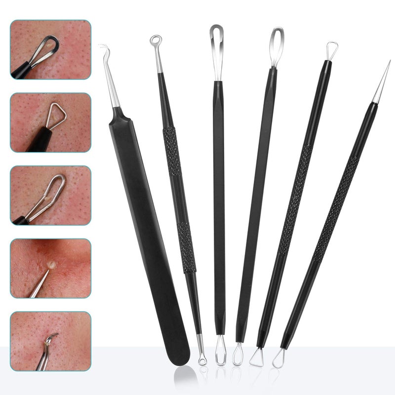 Tomata Blackhead Remover Pimple Popper Tool Kit - (6 Piece Kit) - Professional Stainless Pimples Comedone Extractor Removal Tool - Image 2