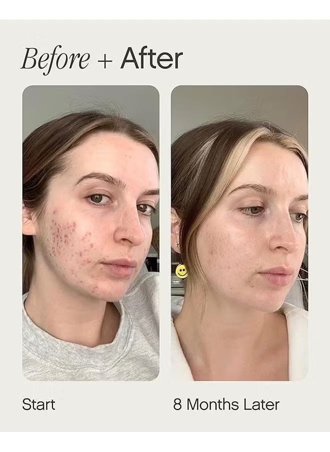 TOPICALS Brightening and Clearing Serum 15ml, Faded Serum for Dark Spots and Discoloration Hyperpigmentation, Postblemish Marks Scars And Spots, Mini Faded Serum for Uneven Skin Tone  - Image 2