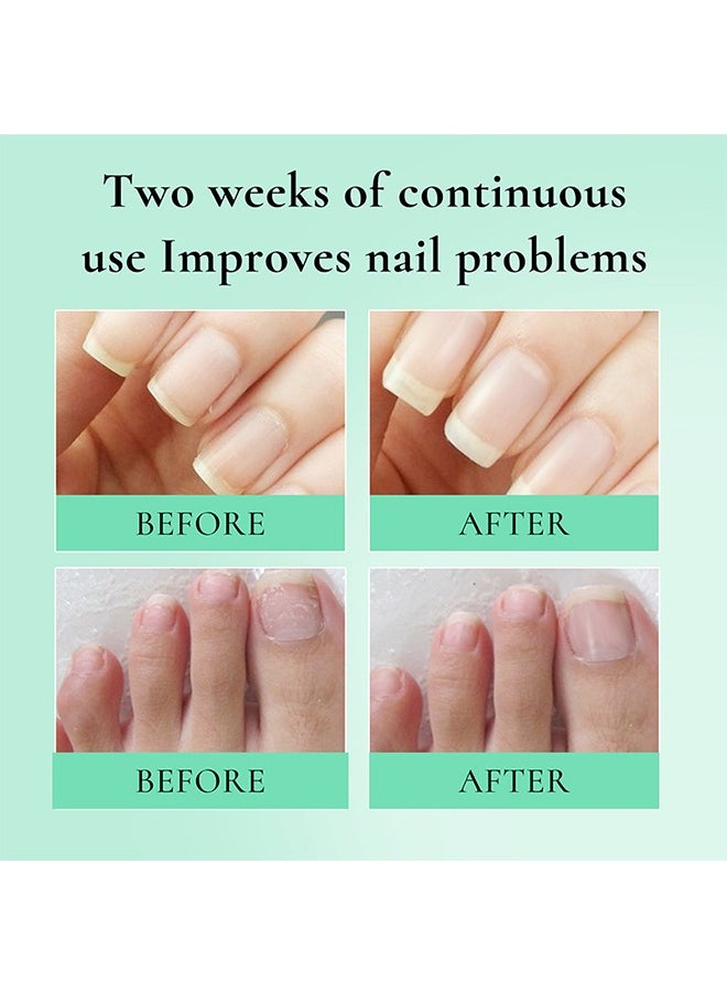 Cuticle Care Oil, Deep Acting Cuticle Oil, Nail Hardener, Nourishes, Moisturizes, Moisturizes Dry And Cracked Nails, Nourishes And Softens Cuticles