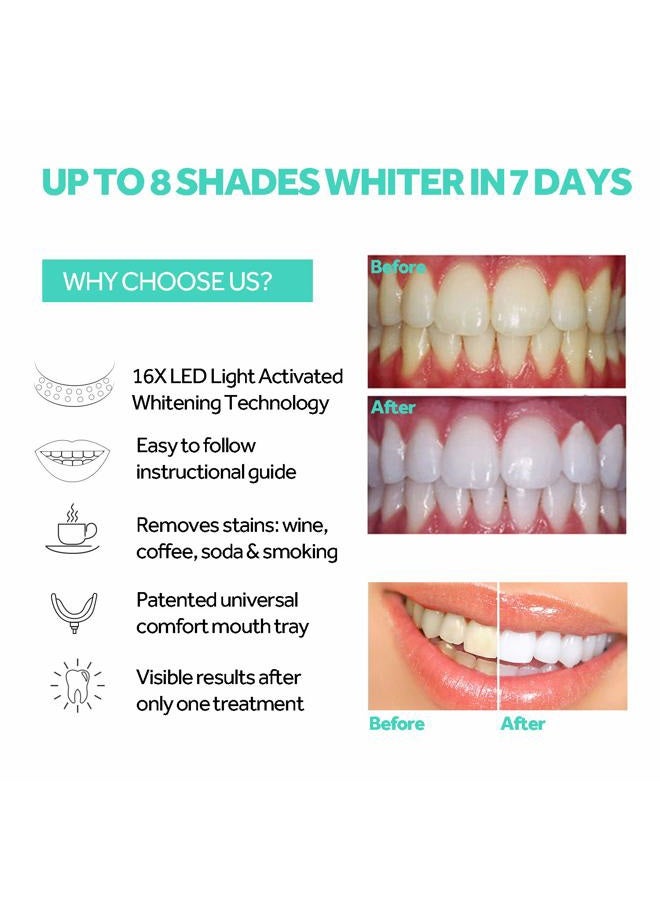 PHOEBE Teeth Whitening Accelerator Light, 16x More Powerful Blue LED Light, Mouth Tray Teeth Whitening Enhancer Light Trays Connected with iPhone/Micro-USB Android/USB for Home Use - Image 3