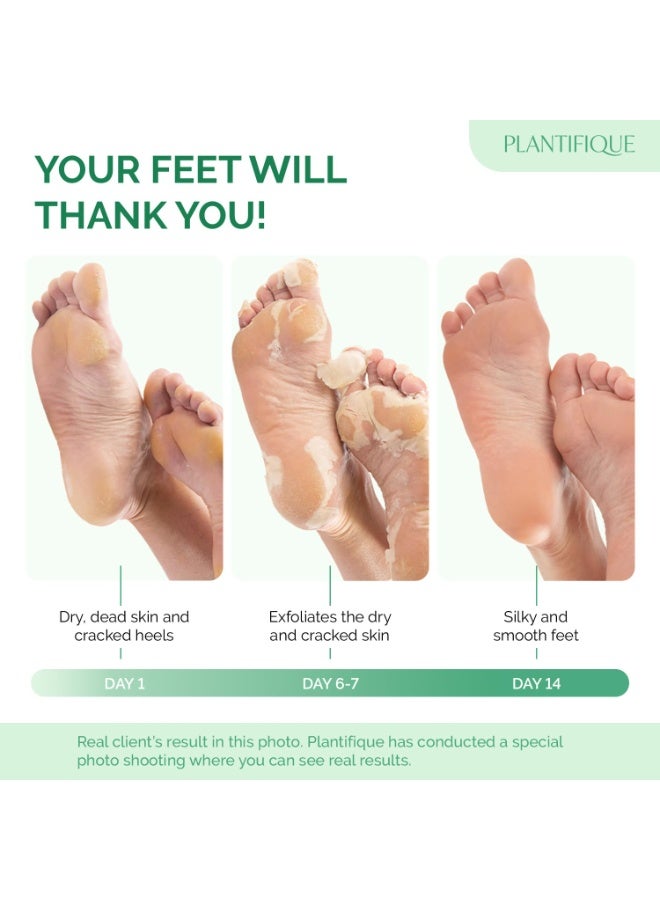 PLANTIFIQUE Foot Peeling Mask - Peeling Foot Mask Dermatologically Tested Repairs Heels & Removes Dry Dead Skin for Baby Soft Feet (Jasmine, 1 Count (Pack of 1)) - Image 2