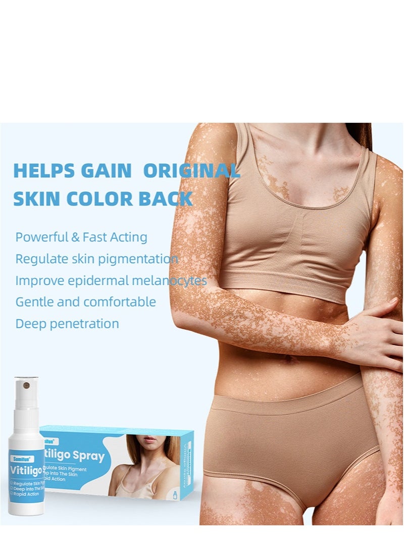 سوميفون بخاخ البهاق، علاج مرطب لإصلاح البشرة، للبقع البيضاء، النمش، بقع العرق، خلاصة للعناية بالبشرة لتحسين لون البشرة، وتعزيز صحة البشرة وتغذيتها (30 مل + 30 مل) - Image 2