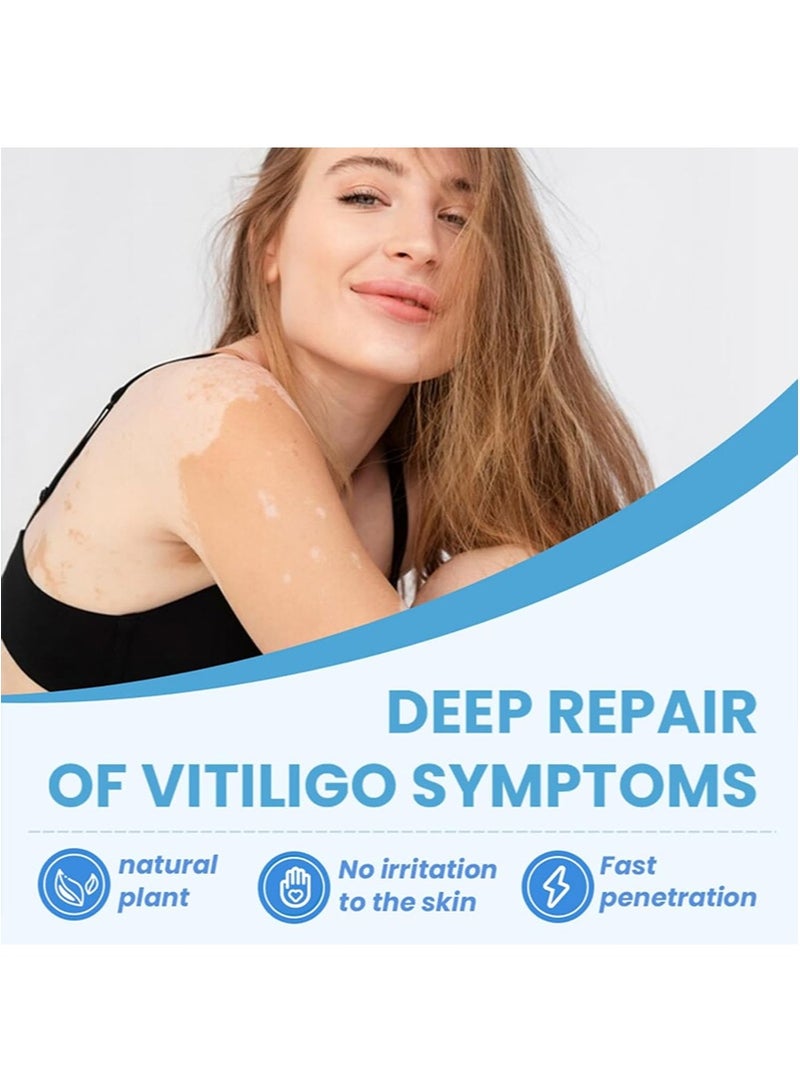 سوميفون بخاخ البهاق، علاج مرطب لإصلاح البشرة، للبقع البيضاء، النمش، بقع العرق، خلاصة للعناية بالبشرة لتحسين لون البشرة، وتعزيز صحة البشرة وتغذيتها (30 مل + 30 مل) - Image 4