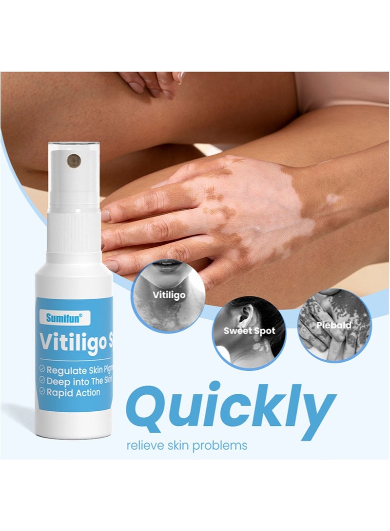 سوميفون بخاخ البهاق، علاج مرطب لإصلاح البشرة، للبقع البيضاء، النمش، بقع العرق، خلاصة للعناية بالبشرة لتحسين لون البشرة، وتعزيز صحة البشرة وتغذيتها (30 مل + 30 مل) - Image 5