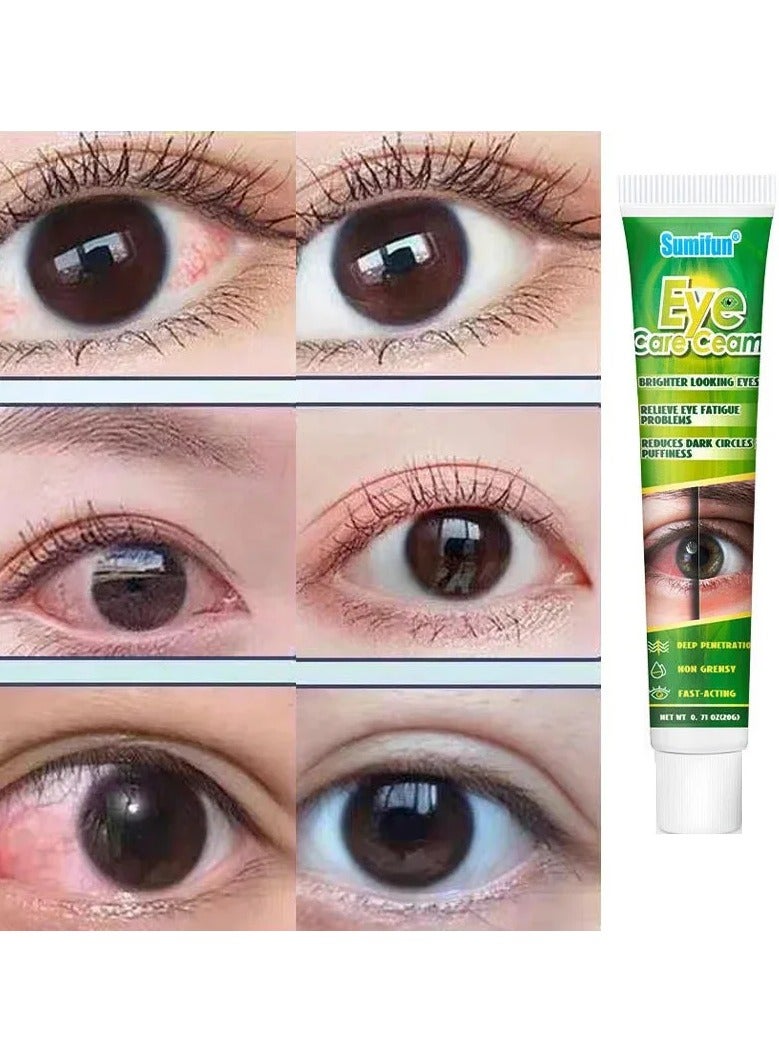 Sumifun كريم العناية بالعيون من الأعشاب لتخفيف تعب العينين للحصول على عيون أكثر إشراقًا يقلل الهالات السوداء والانتفاخ - Image 4