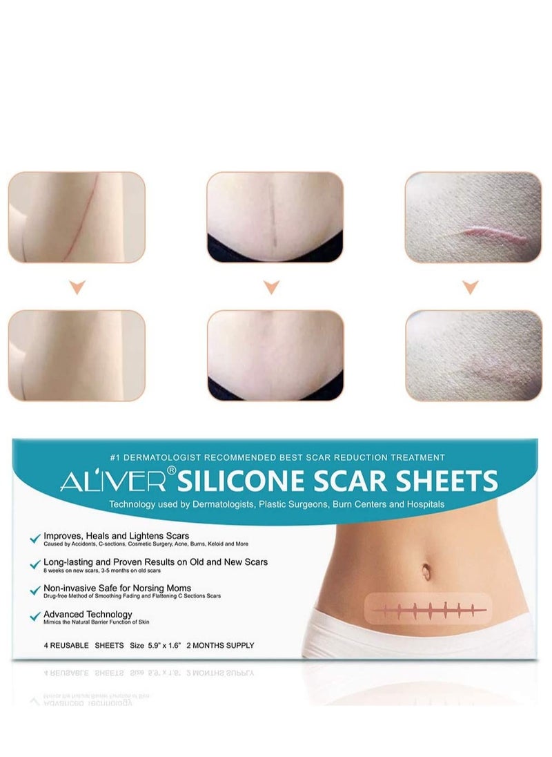 ALIVER - Scar Remover Patch, Silicone Scar Sheets For Scars Stretch Mark Treatment Waterproof, 4 Reusable Sheets, Size 5.9" x 1.6" - Image 1
