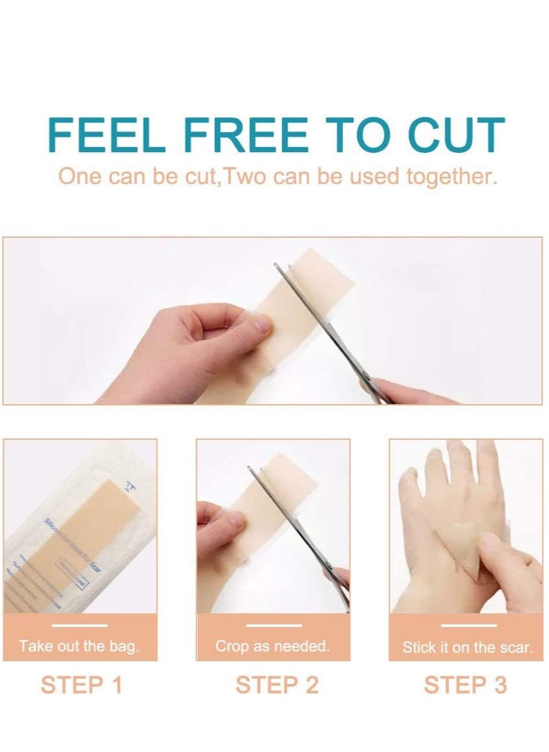 ALIVER - Scar Remover Patch, Silicone Scar Sheets For Scars Stretch Mark Treatment Waterproof, 4 Reusable Sheets, Size 5.9" x 1.6" - Image 1