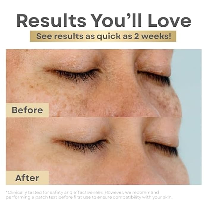 Clear Essence Lemon Plus Vitamin C Serum for Face 0.5oz – Hydroquinone-Free Brightening Serum, Dark Spot Corrector, Skin Lightening for Hyperpigmentation, Even Skin Tone & Glowing Complexion - Image 4