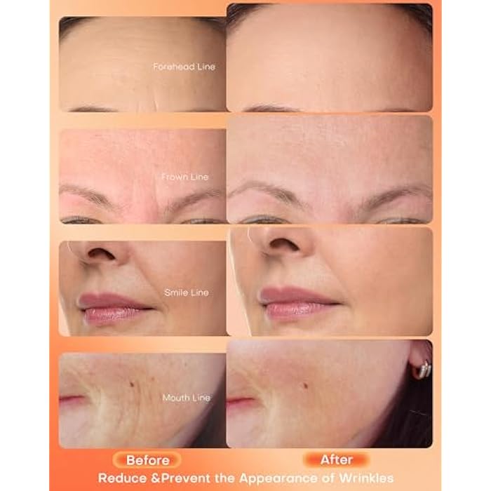 NEWKEY Red Light Therapy Mask for Face,7 Colors LED Face Mask Light Therapy, At-Home Photon Skin Care Beauty Mask for Anti Wrinkles Acne Reduction - Image 3