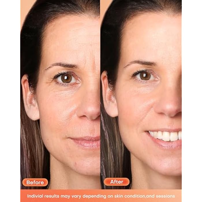 NEWKEY Red Light Therapy Mask for Face,7 Colors LED Face Mask Light Therapy, At-Home Photon Skin Care Beauty Mask for Anti Wrinkles Acne Reduction - Image 2