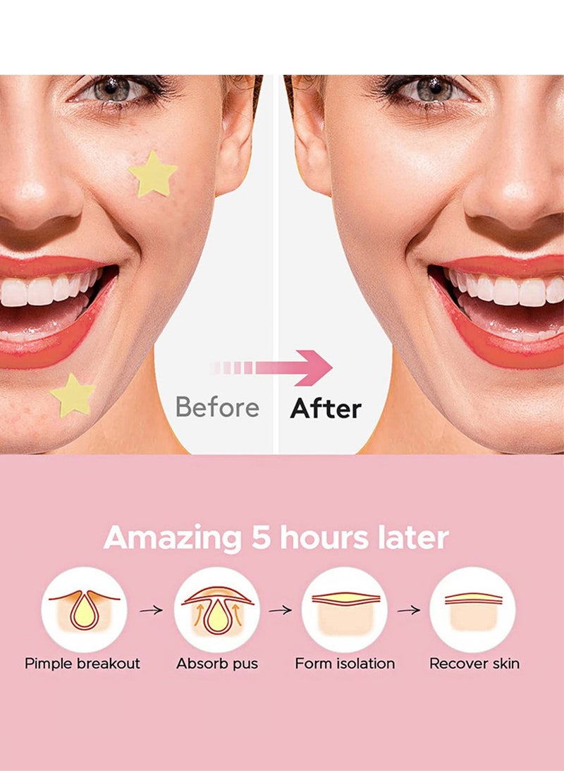 LaPalo - Pimple Patches for Face 120Pcs - Acne Pimple Patches with Hydrocolloid and Salicylic Acid - Star Pimple Patches for Covering Zits, Blemishes, Dark Spots - 6 Cute Shapes - Image 1