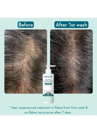 Hydrating Anti Dandruff Shampoo | 100% Dandruff Reduction | Removes Flakes & Hydrates Scalp | Proven Clinically | Piroctone Olamine, Salicylic Acid, AHA & BHA | Paraben & Sulphate Free | For Women And Men - view 4