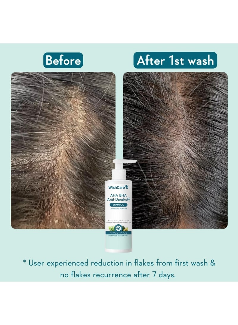 WishCare Hydrating Anti Dandruff Shampoo | 100% Dandruff Reduction | Removes Flakes & Hydrates Scalp | Proven Clinically | Piroctone Olamine, Salicylic Acid, AHA & BHA | Paraben & Sulphate Free | For Women And Men - Image 4