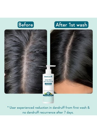 Hydrating Anti Dandruff Shampoo | 100% Dandruff Reduction | Removes Flakes & Hydrates Scalp | Proven Clinically | Piroctone Olamine, Salicylic Acid, AHA & BHA | Paraben & Sulphate Free | For Women And Men - view 3