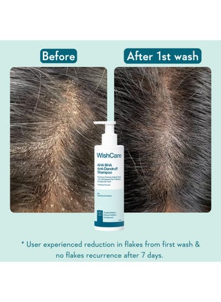 AHA BHA Anti Dandruff Shampoo - view 5
