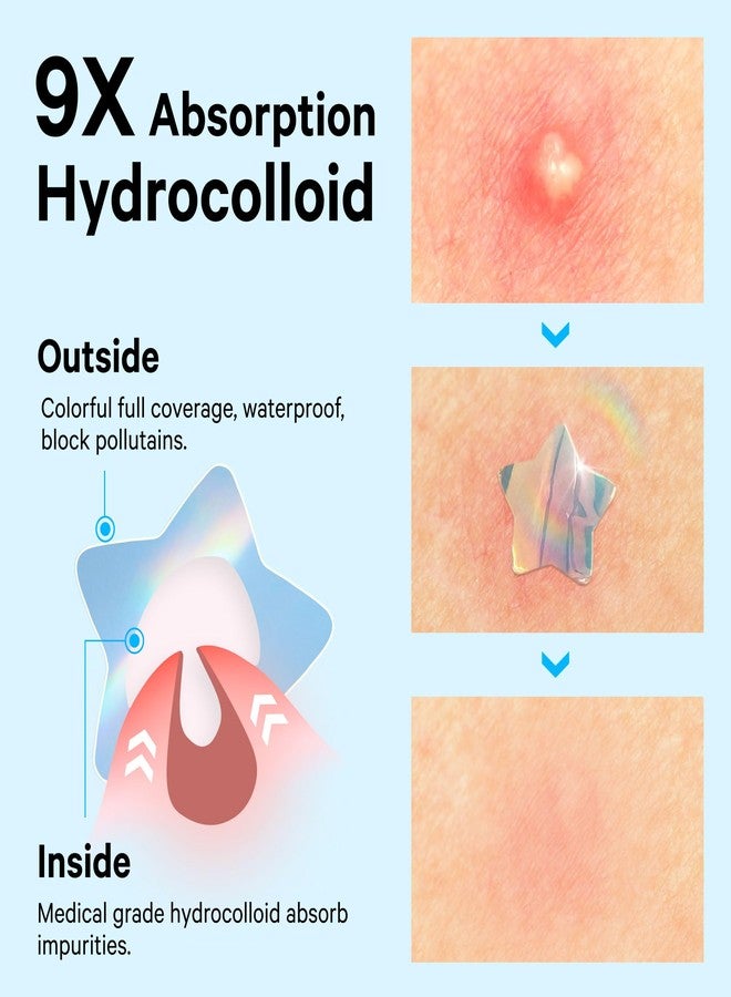 Sosky Hologram Pimple Patches for Face, Hydrocolloid Acne Patches with Salicylic Acid, Cute Star Zit Stickers,Colorful Blemish Covers,36 Count Blue Star Cloud Butterfly - Image 3